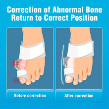 Load image into Gallery viewer, ToeHero™ Bunion Corrector